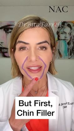 Dr. Bita Zadeh Farrell | Depth of injection plays a role in preventing brow drop or brow ptosis. #botoxbrows #browdrop #botox #botoxtraining #botoxbrowlift… | Instagram Botox Fillers, Dermal Fillers, Facial, Beauty, Instagram