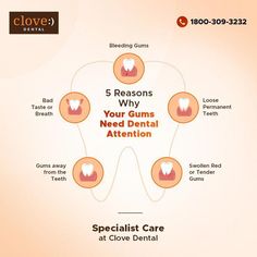 Dentist Content Ideas, Dentist Post Ideas, Dentist Social Media Posts, Dental Post Ideas, Dental Social Media Posts, Dental Content, Clove Dental, Dental Post, Dentist Ideas