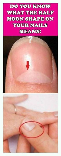 Nail Half Moon, Layers Of The Epidermis, Health And Fitness Articles, Creating A Newsletter, Layers Of Skin, Healthy Beauty, Shape Of You, Moon Shapes