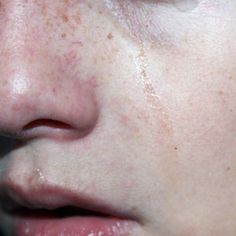 a close up of a person with freckles on their face and nose, looking to the side