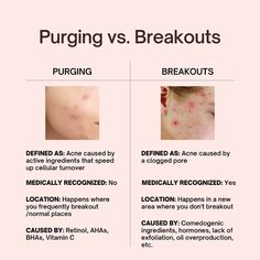 Skin Purging vs. Breakouts—Is your new skincare helping or hurting? Blind Pimple, Forehead Acne, Pimples Under The Skin, Bad Acne, Care Less, Clear Glowing Skin