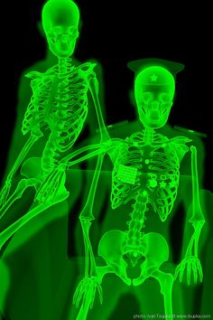 two skeletons in green glow, one is wearing a hat and the other is holding a cane