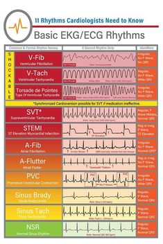 Room Basic, Paramedic School, Cardiac Nursing