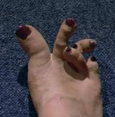 Trendy Nail Ideas Feet Of Shrek, Funny Feet Nails, Toe Pictures Ideas, Feet Nails Ideas, Gross Nails, Sus Pics, Ugly Toes, Ugly Legs