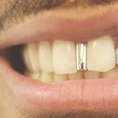 Gap filler, Gold Strip Design Gap Grillz, Teeth Caps, Teeth Art, Strip Design, Gold Grillz, Gap Teeth, Grills Teeth, Tooth Gem, Gold Teeth