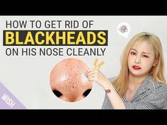 This video is about the essential tips for caring for blackheads properly. Kasper will help to remove special guest, Roy's blackheads cleanly. :)Hope this vi... Blackhead Remover Tool, Blackheads On Nose, Rid Of Blackheads, Blackhead Removal, Dry Skin Patches, Get Rid Of Blackheads, Peel Off Mask, Unwanted Hair Removal