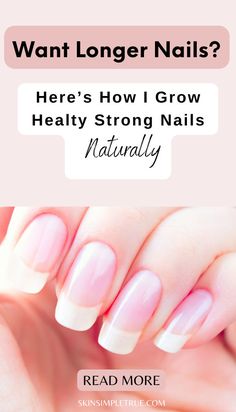 grow nails faster and stronger Grow Nails Faster And Stronger, Simple Nails Aesthetic, Grow Long Nails, Healthy Cuticles, Nail Growth Tips, Grow Nails Faster, Nail Conditions