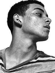 a black and white photo of a man with freckles on his face looking off to the side