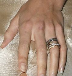 a woman's hand with two rings on it