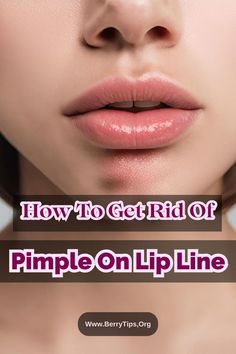 Learn what causes pimples on Lipline and find effective treatments to get rid of them. Discover tips to prevent future breakouts. Pimples On Lip Line, Neck Pimples, Deep Pimple, What Causes Pimples, Lip Pimple, Peroxide For Acne, Painful Pimple, Pimple Solution, Pimple Causes