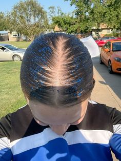 Gel+glitter=✨🤩 Glitter On Hair, Glitter Hairstyles, Cheer Hairstyles, Cheer Athletic, Running Hairstyles, Volleyball Hair, Track Hairstyles, Cheerleading Hairstyles, Hair Glitter