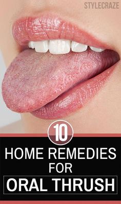 Oral thrush is an infection caused by Candida albicans. But can the white lesions be treated? Can you prevent oral thrush? Check these 15 home remedies here Sensitive Teeth Remedy, Best Teeth Whitening, Oral Care Routine, Health Design, Sensitive Teeth, Simple Home