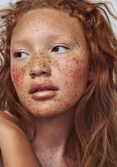 a woman with freckles on her face