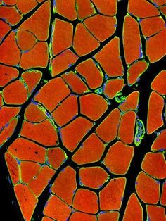 size: 24x18in Photographic Print: Skeletal Muscle Fibres, Light Micrograph by Thomas Deerinck : Microscope Photography, Microscopic Photography, Micro World, Micro Photography, Kunst Tattoos, Microscopic Images, Under The Microscope, Skeletal Muscle, Plant Stem