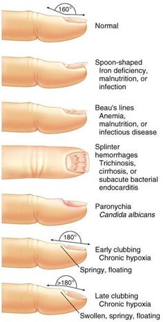 Nail Health Signs, Mindset Therapy, Nail Problems, Nail Types