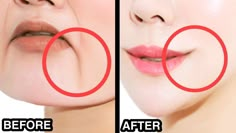 Jowl Exercises How To Get Rid, Marionette Lines Exercises, Marionette Lines Before And After, Get Rid Of Marionette Lines, Jowl Exercises, Droopy Face, Facial Exercises For Jowls, Face Lift Exercises, Face Massage Anti Aging