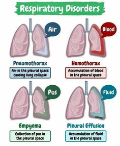 the different types of lungs and their corresponding functions are shown in this diagram, which shows