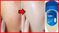 Vaseline For Face, Vaseline Original, Vaseline Uses, Vaseline Beauty Tips, Beauty Hacks Lips, Petroleum Jelly, Beauty Tricks, Unwanted Hair Removal, Natural Beauty Tips