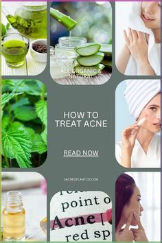 Looking for natural ways to treat acne? Explore Sacred Plant Co’s guide to the best herbs and remedies for acne treatment. From aloe vera to nettle and tea tree oil, learn how these organic solutions can help soothe and heal your skin. Whether you're looking for morning or night routines, these herbal treatments will leave your skin clear and glowing. Click through for more skincare tips and holistic remedies that really work! Treat Acne Naturally, Remedies For Acne, Night Routines, Bulk Herbs, Natural Acne Remedies, Sacred Plant, Natural Acne, Treat Acne, Skin Clear