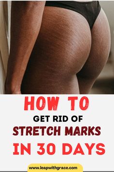 Get rid of your strectch marks in as little as 30 days with consistent work. Hygiene Products Aesthetic, Smell Good All Day, Skincare Routine Tips, Skincare Routine Products, Western Nursery, How To Smell Good, Products Aesthetic, Working Mom Life