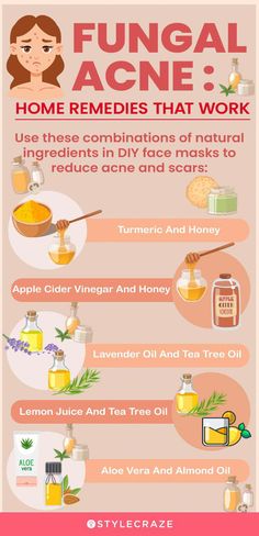 Are you dealing with whiteheads or skin irritation? You may have fungal acne that’s often confused with acne vulgaris. Know the causes and treatments here. Fungal Acne, Turmeric And Honey, Acne Vulgaris, Diy Acne, Natural Acne Remedies, Natural Acne, Home Remedies For Acne