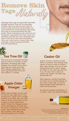 #NaturalHomeRemediesForCough Apple Cider Vinegar For Skin, Remove Skin Tags Naturally, Remove Skin Tags, Skin Moles, Cold Sores Remedies, Skin Tags, Glow Skin, Skin Remedies, Natural Home Remedies