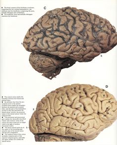 two different views of the human brain