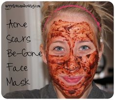 Acne Scars Be-Gone Face Mask. 1/2 tsp cinnamon 1/2 tsp nutmeg 1 tsp honey 2ish tsp lemon juice. (I used the juice from 1/4 of a lemon) apply for 20 minutes health-and-beauty Burning Face Mask, Makeup Tip, Natural Face Mask, Astringent, Mascara Facial, The Burning, Diy Beauty Hacks