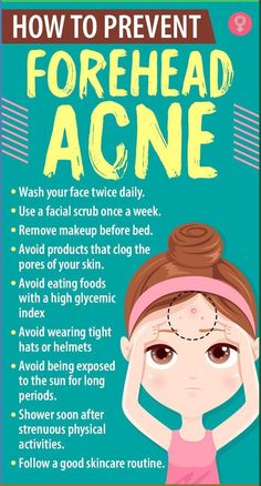 How To Prevent Forehead Acne: If you are looking for ways to prevent acne, the first step is to maintain excellent personal hygiene. Cleansing your face after exposure to pollution, grime, and dust can help prevent acne. Here are a few tips to prevent forehead acne: #acne #foreheadacne #skincare #skincaretips #beauty #beautytips Pimples On Forehead, Forehead Acne, Pimples Under The Skin, Bad Acne, Acne Overnight, Sunday Routine, Prevent Pimples, Acne Face Wash, Natural Acne Remedies