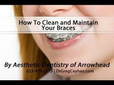 ▶ How To Clean and Maintain Your Braces - YouTube Braces Aesthetic, Teeth With Braces, Teeth Aesthetic, Dental Products, Your Smile