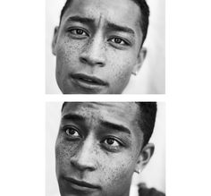 three different pictures of a man with freckles on his face