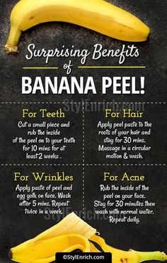 Banana Peel Uses, Banana Benefits, Hair Care Remedies, Banana Peel, Beauty Tips For Glowing Skin, Healthy Skin Tips, Skin Care Remedies, A Banana, Healthy Skin Care