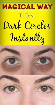 Saggy Eyelids, Brown Age Spots, Dark Circle Remedies, Lengthen Eyelashes, Brown Spots On Skin, Face Tightening, Skin Moles, Natural Mask, Dark Eye Circles