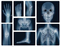 an x - ray view of the human skeleton with different bones, including the upper and lower limbs