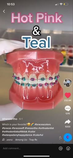 Cotton Candy Braces, Braces Color Combo Ideas, 2 Braces Colors Ideas, Neon Braces Colors, Cute Braces Colors Combinations, Teal And Pink Braces, Braces Combination Colors, August Braces Colors, Pink And Blue Braces