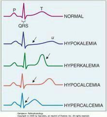 Nursing Infographic, Electrolyte Imbalance, Paramedic School, Vet Medicine, Medical Student Study, Cardiac Nursing, Medicine Student