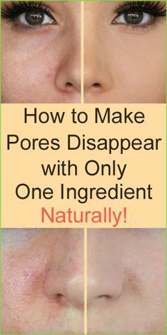 Face Pores, Face Wrinkles, Skin Care Remedies, Beauty Skin Care Routine