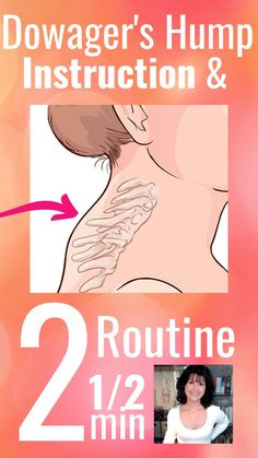 a woman's neck and shoulder with the words dowager's hump instruction