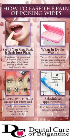 dental tips Prevent Bad Breath, Dental Tips, Baby Care Tips, South Jersey, First Tooth