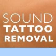 the words sound tattoo removal are in white letters