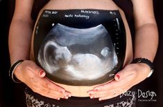 a pregnant woman holding an x - ray image in her belly with both hands on her stomach