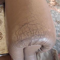 a person's leg with the skin on it