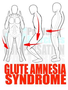 how to do the glute amnesia syndrome