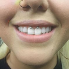 a close up of a person's smile with braces on their teeth and nose piercings