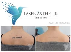 Hair Removal, Tattoo Quotes