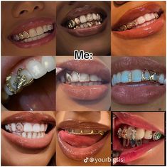 many different types of teeth with braces and piercings on them are shown in this collage