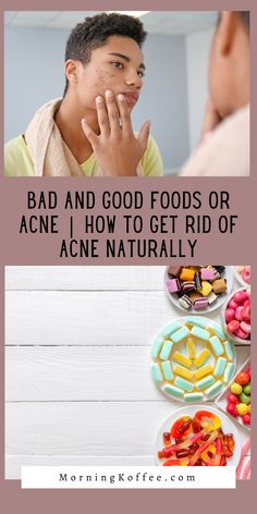 Which foods might help to improve acne? These are bad and good foods to help you get rid of acne. If your skin is vunerable with pimples or breakout hen you might want o be more aware wi your diet. Or in case you are know in the stage of fighing acne, this article will help you to ge rid of pimples naturally. hese are acne diet you need to follow for fewer pimples and clearer skin. acne diet, anti acne diet, bad food for acne, good food for acne, what to eat if you have acne. Foods To Avoid