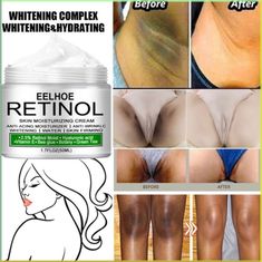 Underarm Bleaching, Body Whitening Cream, Armpit Whitening, Body Whitening, Skin Lightening Cream, Diy Skin Care Routine, Dark Underarms, Good Skin Tips, Dark Spots On Skin