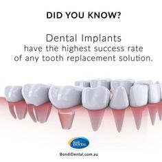 Dental World, Best Dental Implants, Dental Facts, Tooth Replacement, Family Dentist