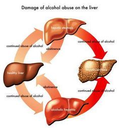 Liver Cleanse Juice, Liver Failure, Cell Therapy, Healthy Liver, Body Organs, Liver Health, Stem Cells, Disease, Health